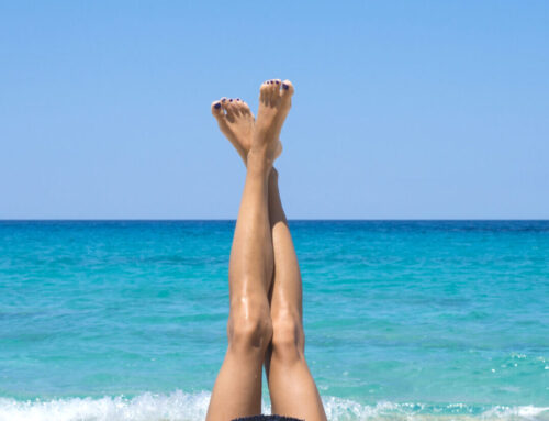 Depilación láser en verano, ¿se puede hacer?